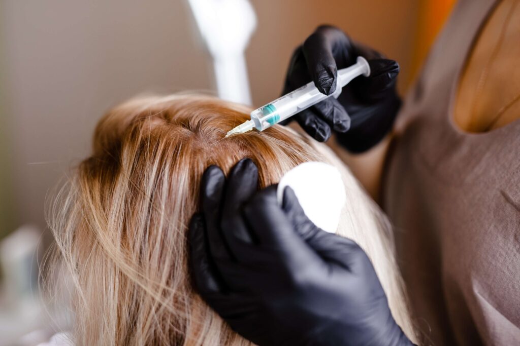 Person receiving a hair treatment with a syringe being injected into the scalp